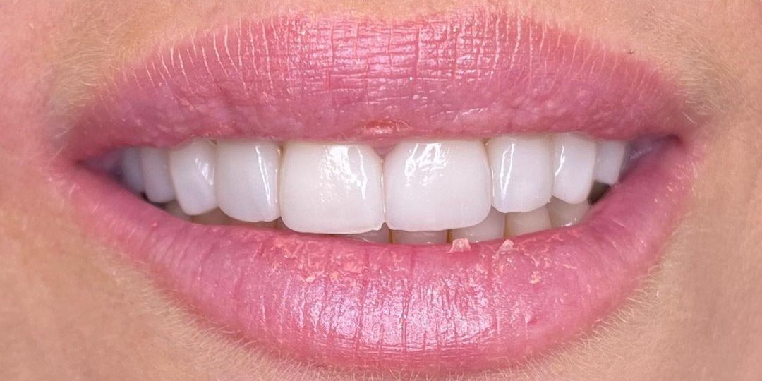 403121805_360556429841187_130464910653849908_n (1)