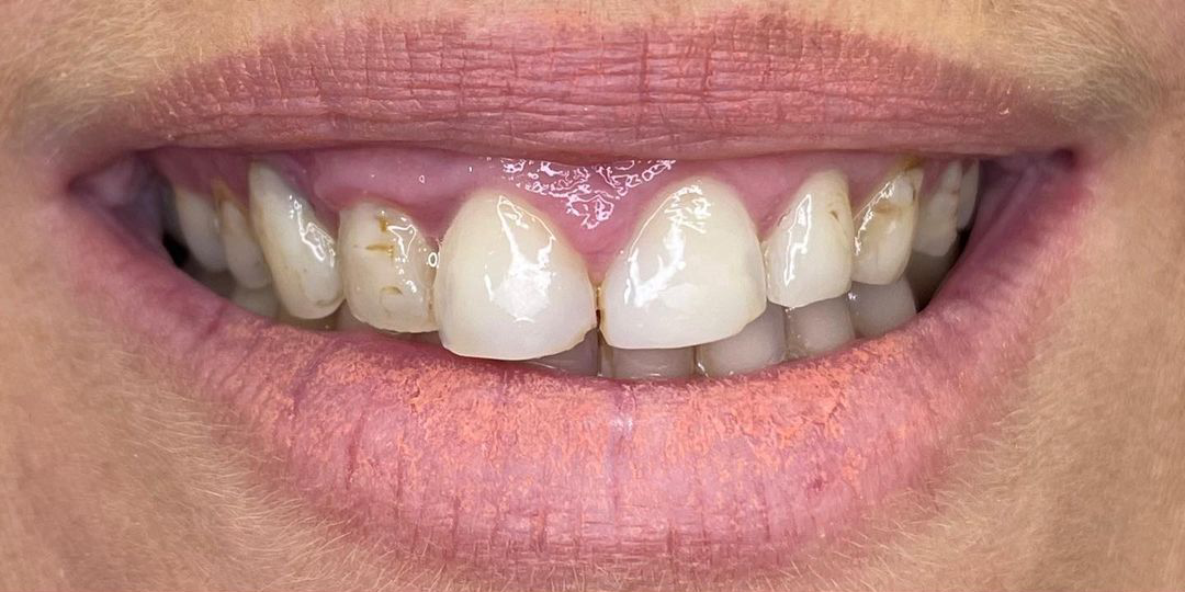 403121805_360556429841187_130464910653849908_n 403121805_360556429841187_130464910653849908_n