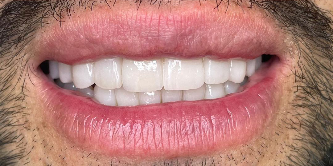 403941719_991621201926478_927575508712408369_n (1)