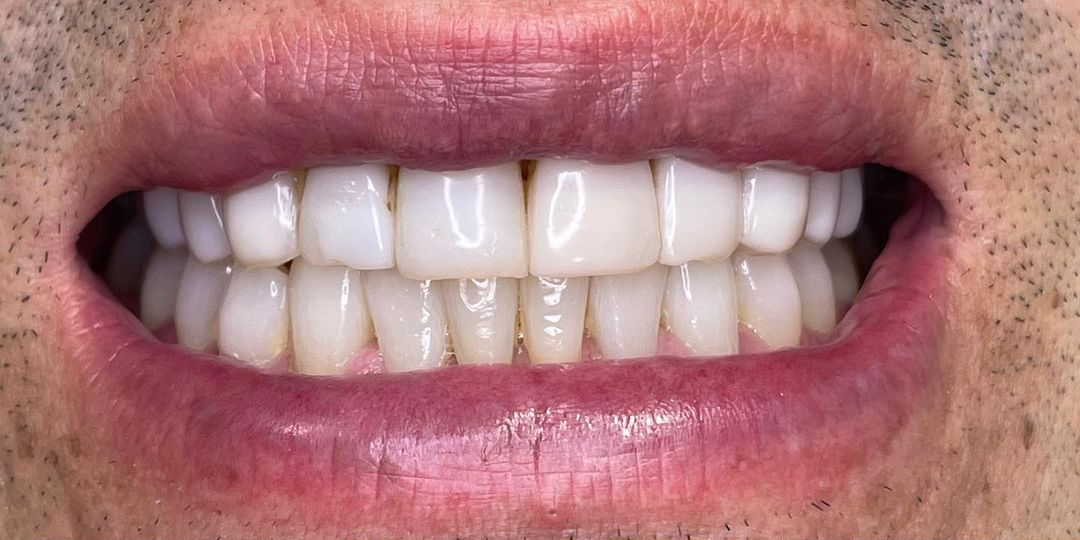 403941719_991621201926478_927575508712408369_n 403941719_991621201926478_927575508712408369_n